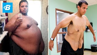 The Incredible Shrinking Man  Jesse Shand Lost 350 Pounds [upl. by Latham]