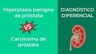 Hiperplasia benigna de próstata vs Carcinoma de próstata Diagnóstico Diferencial [upl. by Faden]