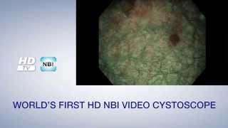 Olympus NBI Urology Video  English Version [upl. by Ilak]