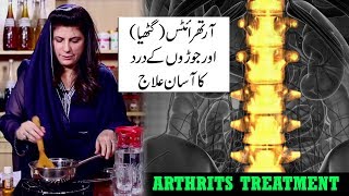 Arthritis Gathiya Joint Pain Treatment by Dr Bilquis Shaikh  Joron k Choron Dard ka Ilaaj [upl. by Suivatram]