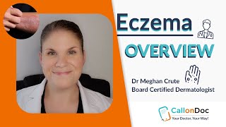 CallOnDoc Dermatologist Explains Eczema [upl. by Fanestil]