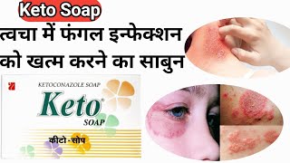 Keto Soap  कीटो साबुन के फायदे और लगाने का तरीका  Ketoconazole Soap  shorts [upl. by Shanda]