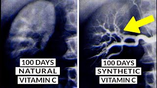 We Finally Know What Type Of Vitamin C Is Best [upl. by Eimac705]