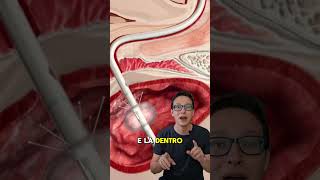 Como voce urina na cirurgia 😯🚽 enfermagem medico saude curiosidades [upl. by Sanjiv]