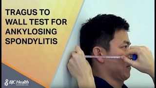 Tragus to Wall test for Ankylosing Spondylitis [upl. by Tegdig806]