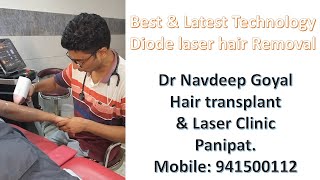 Best and Latest technology Laser Hair Removal Machine in World Dr Navdeep Hair transplant amp Laser [upl. by Enomar]