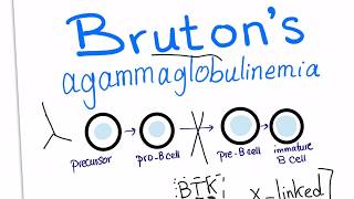 Brutons agammaglobulinemia Xlinked agammaglobulinemia with a mnemonic [upl. by Saito]