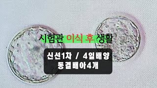 시험관 브이로그 시험관 이식 당일 신선1차 4일배양  동결배아 갯수  무증상이라 더 이상해😜 [upl. by Yttisahc]