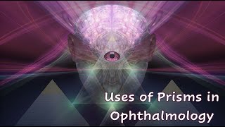 Prisms in Ophthalmology 2  Clinical Uses of Prisms [upl. by Linnell461]