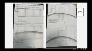 The macula – a user’s guide Aman Chandra [upl. by Harat370]