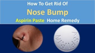 How to Get Rid Of Nose Bump  Aspirin Paste Home Remedy [upl. by Gleeson]