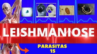 LEISHMANIOSE VISCERAL E LEISHMANIOSE TEGUMENTAR LEISHMANIA SSP  PARASITOLOGIA INFECTOLOGIA [upl. by Ybeloc]