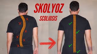 Skolyoz İçin 4 Egzersiz  4 Scoliosis Exercises [upl. by Roel]