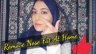 Remove Nose fat with this home remedy naturally amp get slim sharp nose Reshape nose home remedy [upl. by Esilegna]