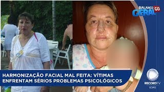 HARMONIZAÇÃO FACIAL MAL FEITA VÍTIMAS ENFRENTAM SÉRIOS PROBLEMAS PSICOLÓGICOS [upl. by Newell]