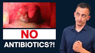 Antibiotics for Strep Throat Do We Need Them [upl. by Rozanne]