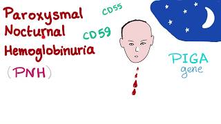 Paroxysmal Nocturnal Hemoglobinuria PNH  Hemolytic Anemia  Complement Alternative Pathway [upl. by Mullane]