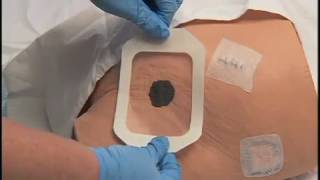 3M™ Tegaderm™ Antimicrobial IV Advanced Securement Dressing 9132 Application and Removal video [upl. by Perlie]