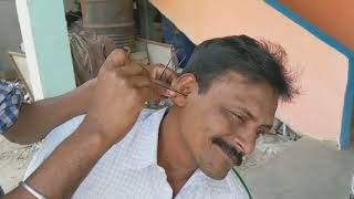 Letest ear cleaning by road side ear cleaner  satisfying ear cleaning with medicine  ear wax [upl. by Kantor]