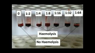 How to Determine antibody titer [upl. by Atiugram]