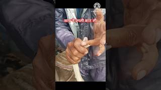 उंगली ही काट ली साप ने ytshorts shorts youtubeshorts shortvideo manojsnakesever [upl. by Arahsak]