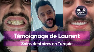 CLINIQUE DENTAIRE TURQUIE  🦷 Témoignage laurent  gummy  7 implants  28 couronnes  BODYEXPERT [upl. by Othello]