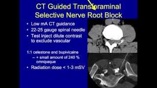 UCSF Radiology What to Expect After the Injection [upl. by Sophie]