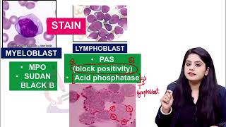 White Blood Cells Pathology Rapid Revision For FMGE amp NEET PG By Dr Preeti Sharma [upl. by Adnawuj]