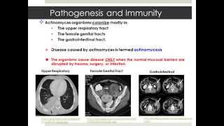 Actinomyces [upl. by Terrell737]