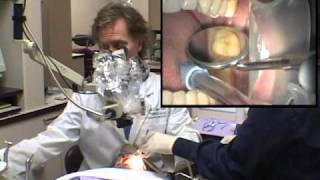 Dr David Clark Modern Version of Sealants Part 1 [upl. by Schafer]