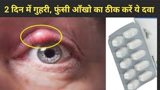 आँखो का गुहरी फुंसी सूजन दर्द 2 दिन में ठीक करें ये दवा  how to get rid of stye on eyelid fast [upl. by Lupiv]