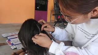 DSCN0710 Lice Removal  GROSS Lice Popping and Nitpicking From Hair [upl. by Ardnaid144]