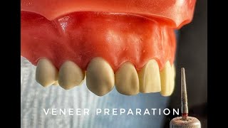 Veneer Preparation [upl. by Nesahc]