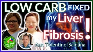 004 DIABETES at LIVER FIBROSIS Gumaling sa LOW CARB Ft ANN TOLENTINOSALDAÑA ng PerfectMatch [upl. by Patric421]