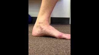 Is your Foot Tripod Stable enough to walk or run pain  problem free  quotThe Wobbling Tripod Videoquot [upl. by Cupo]