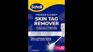 NEW Scholl Freeze Away Skin Tag Remover effectively removes skin tags in as little as 1 treatment [upl. by Yemane]