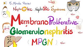 Membranoproliferative Glomerulonephritis Type 1 and 2  MPGNI amp MPGNII  Nephrology [upl. by Lowenstern]