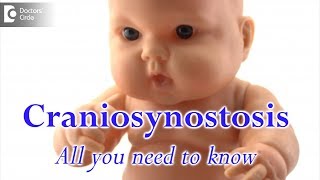 Craniosynostosis  All you need to know  Dr Derick Mendonca [upl. by Atlas]