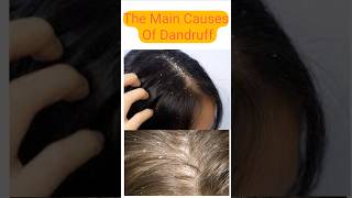 The main reasons of dandruff shortsvideo smartlylearnwithfun [upl. by Modestine]