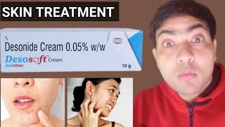 desosoft cream use in hindi [upl. by Samul]