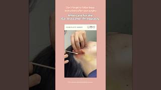 ENG Aftercare for the Ear Area after Rhinoplasty  Have questions about postsurgery care [upl. by Vin998]