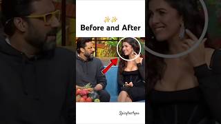 Nimrat kaur Before amp after lip filler💋 shorts ytshortsyoutubeshorts abhishekbachchan nimratkaur [upl. by Eadas]