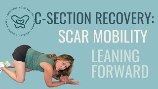 Csection Recovery Scar Mobility in Leaning Forward Position [upl. by Ahsien]