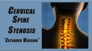 Best Exercises for Stenosis in the Cervical Spine  Slower Pace and More Reps [upl. by Izogn]