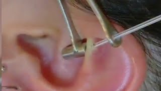 ROOK PIERCING  Ear piercing  Step by step [upl. by Holman]