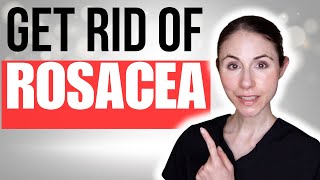 How To Get Rid Of Rosacea  Dermatologist Tips [upl. by Santini384]