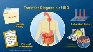 Diagnosing IBD [upl. by Nodnelg]