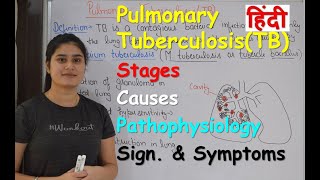 Pulmonary Tuberculosis in Hindi  Stages  Causes  Pathophysiology  Sign amp Symptoms [upl. by Kimmi854]