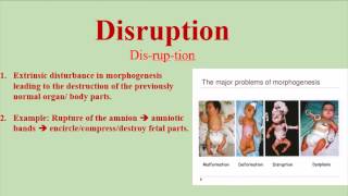 Disruption Pronunciation and Definition  How to pronounce Disruption [upl. by Ybrek]