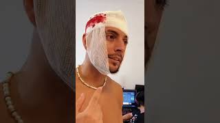 CORTE con NAVAJA SALE MAL🩸☠️ tiktok youtube memes shorts Coscu [upl. by Wilden]